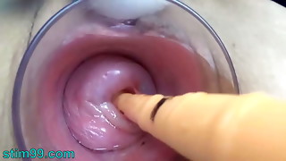 Japanese Milf Cervix Fucking with German real penis dildo and asian chopsticks